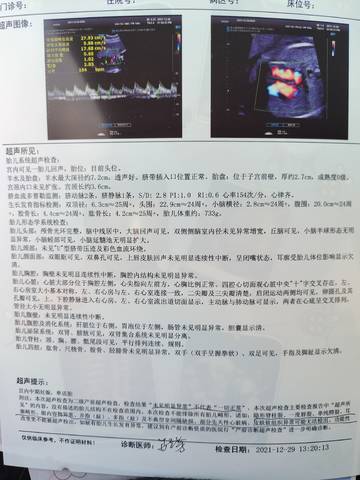 journal_insert_pic_1688337811