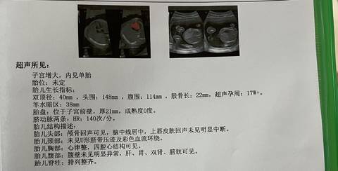 journal_insert_pic_1688187444