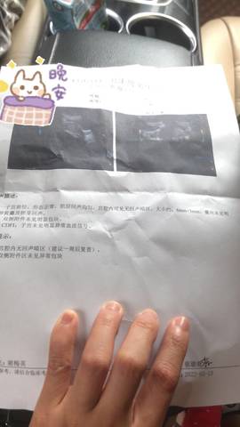 journal_insert_pic_1740810074