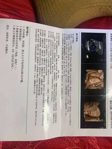 journal_insert_pic_1674101246