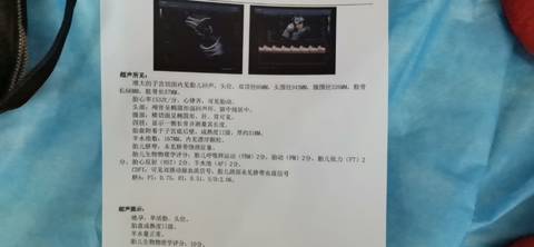 journal_insert_pic_1675371755