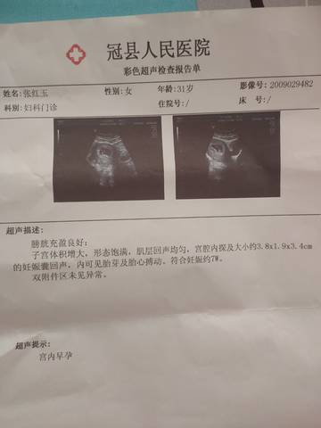 journal_insert_pic_1675367896