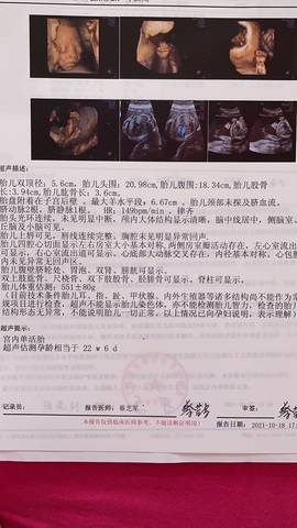 journal_insert_pic_1674223274