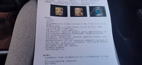journal_insert_pic_1674133935