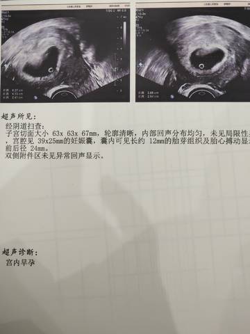 journal_insert_pic_1686486196