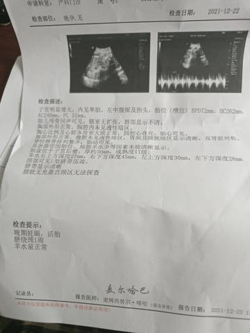 journal_insert_pic_1684264332
