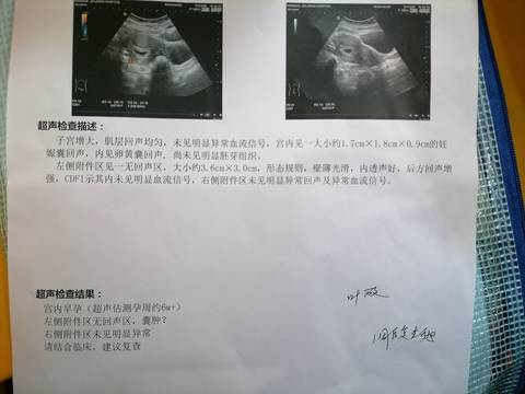 journal_insert_pic_1689051056