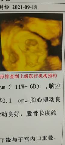 journal_insert_pic_1683854010