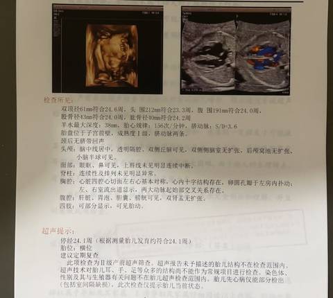 journal_insert_pic_1740876902