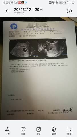 journal_insert_pic_1689679996