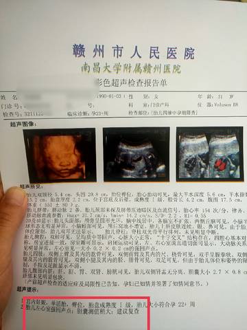 journal_insert_pic_1673728893