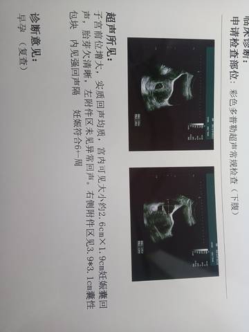 journal_insert_pic_1675330848