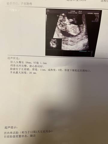 journal_insert_pic_1685933717