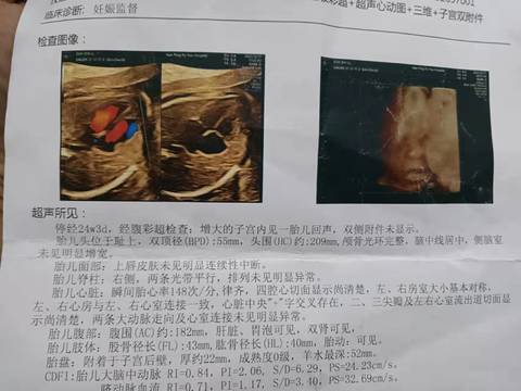 journal_insert_pic_1683763835