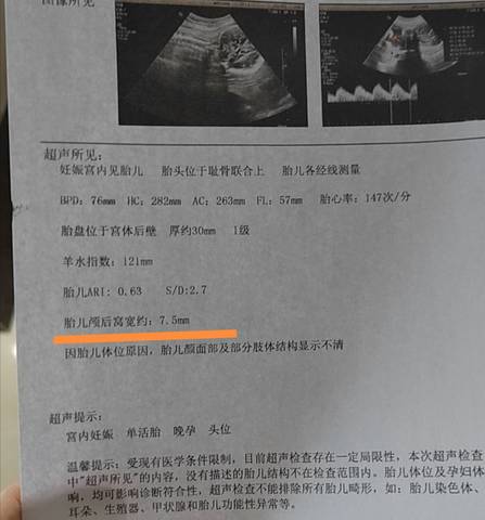 journal_insert_pic_1676120715