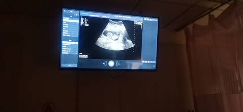 journal_insert_pic_1688778882