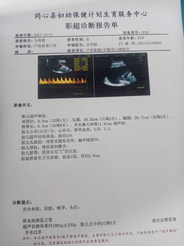 journal_insert_pic_1684919971