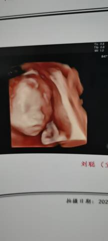 journal_insert_pic_1676951917