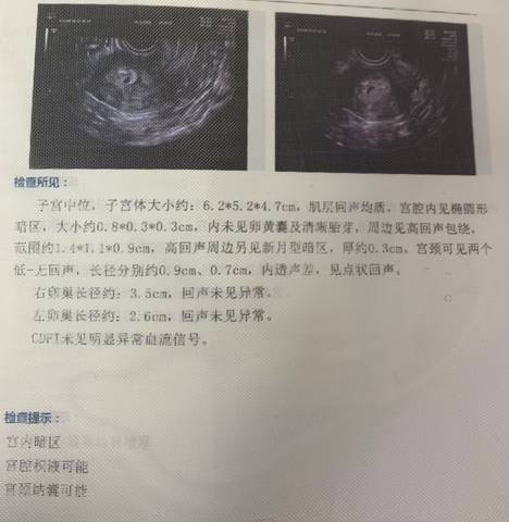 journal_insert_pic_1682161178