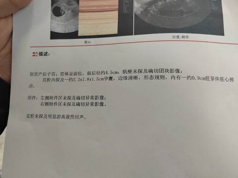 journal_insert_pic_1682535367