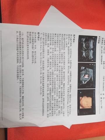 journal_insert_pic_1690575212