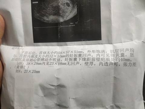journal_insert_pic_1676214087