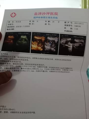 journal_insert_pic_1677359470