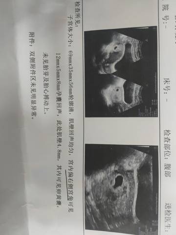 journal_insert_pic_1690347105