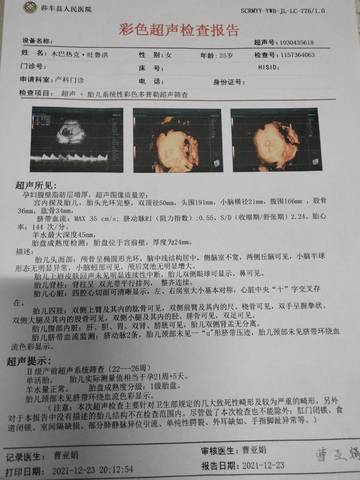 journal_insert_pic_1684981135