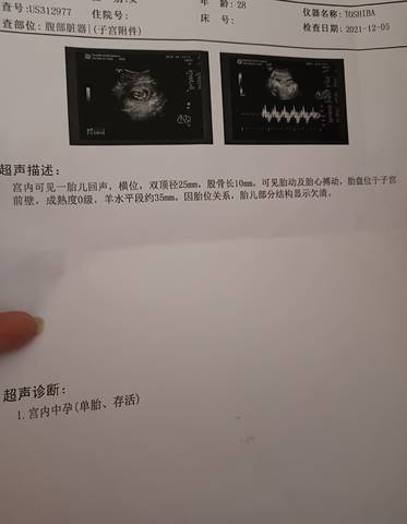 journal_insert_pic_1674082378