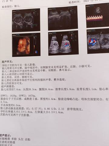 journal_insert_pic_1680128954