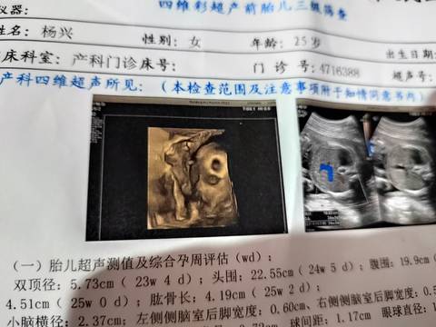 journal_insert_pic_1690582150
