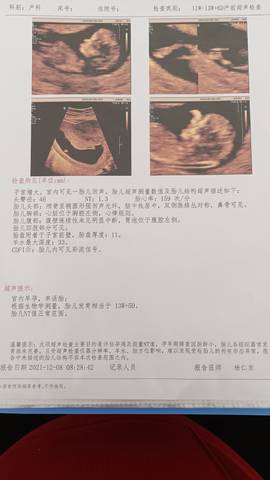journal_insert_pic_1676062595