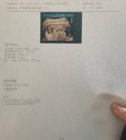 journal_insert_pic_1675315229