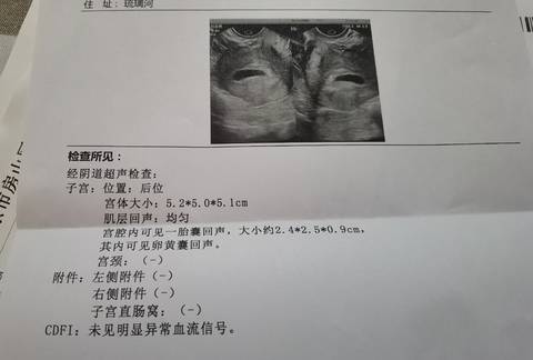 journal_insert_pic_1674298762