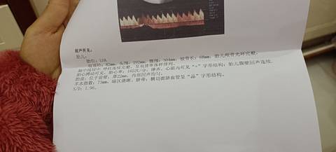 journal_insert_pic_1675012314