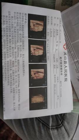 journal_insert_pic_1679300307