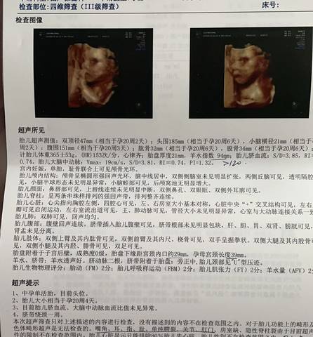 journal_insert_pic_1674040214