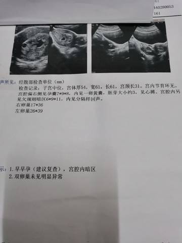 journal_insert_pic_1685438489
