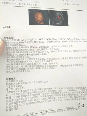 journal_insert_pic_1674840559