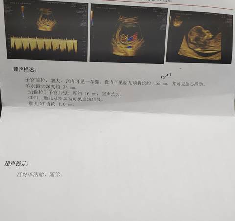 journal_insert_pic_1686821241
