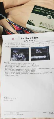 journal_insert_pic_1686392894