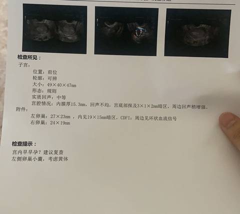 journal_insert_pic_1674786488