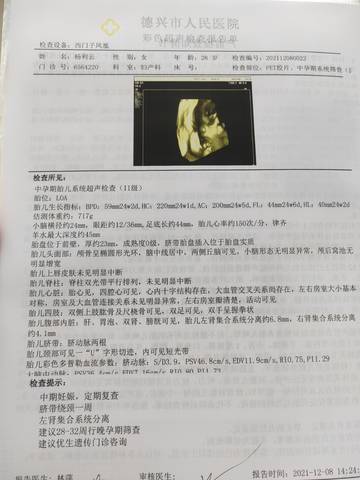 journal_insert_pic_1676099562