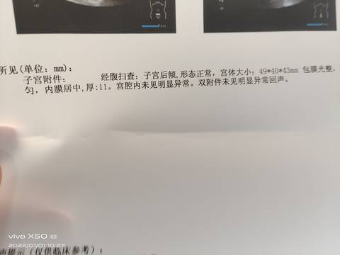 journal_insert_pic_1689999197