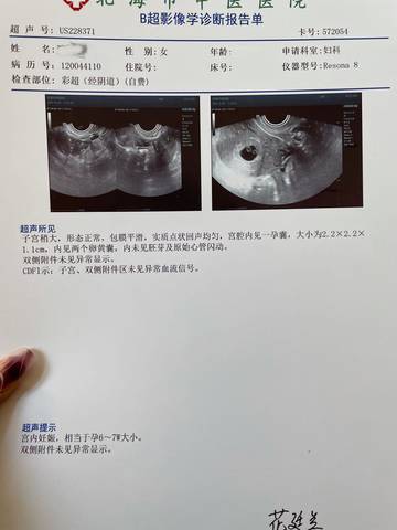 journal_insert_pic_1681355480