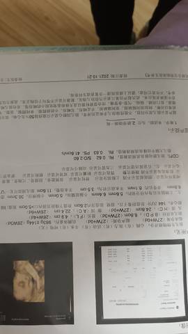 journal_insert_pic_1674421158
