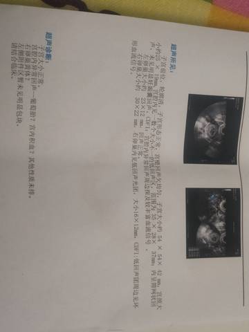 journal_insert_pic_1719838641