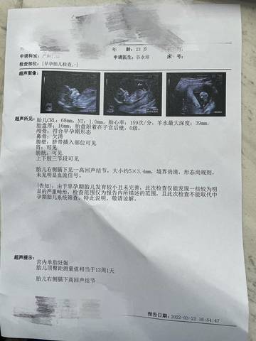 journal_insert_pic_1740927088