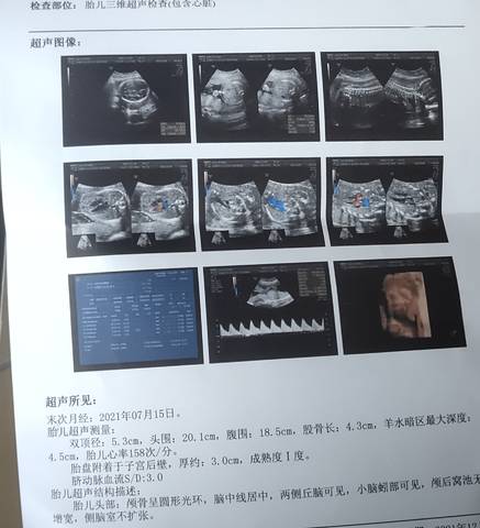 journal_insert_pic_1688573152